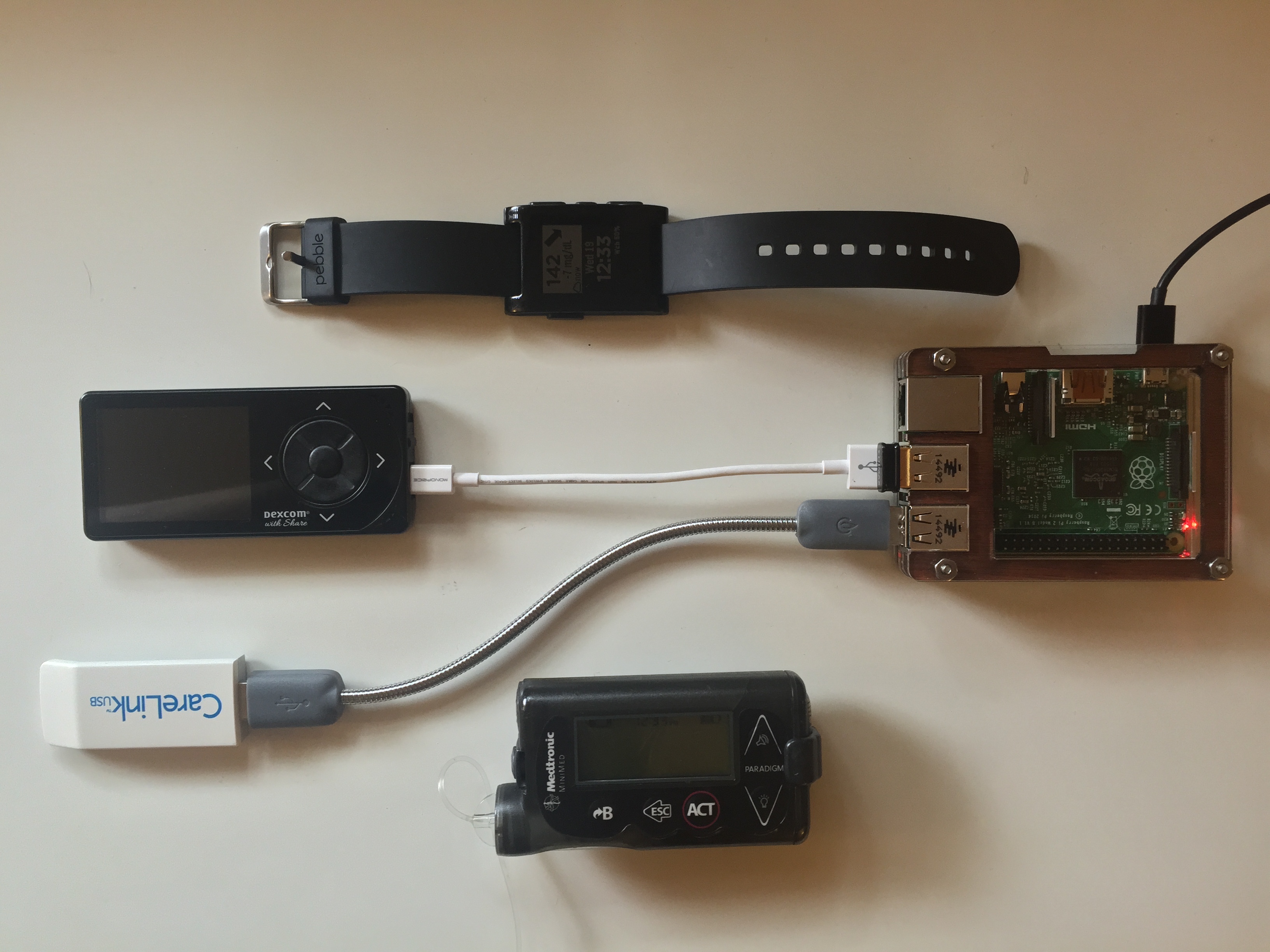 Example OpenAPS Setup